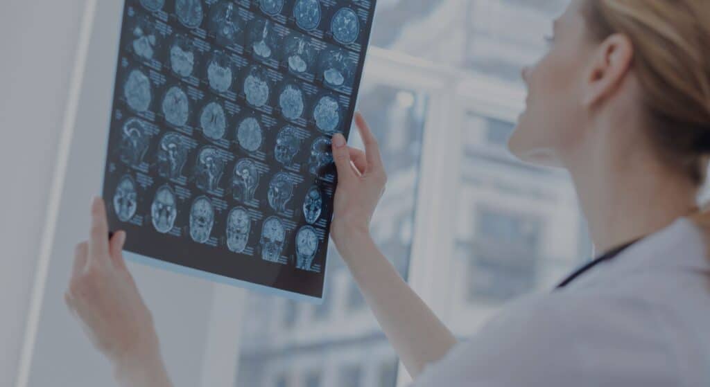 Doctor looking at brain scans|Multiple Sclerosis Center of Atlanta door sign|Doctors analyzing brain scans|Talking with patient|Team of doctors