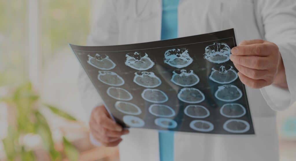 Docotr holding brain scans|Patient getting treatment|Stethoscope on a notepad & books|Doctor performing brain scan|Doctor holding plastic brain with patient