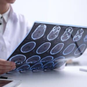 doctor looking at brain scans