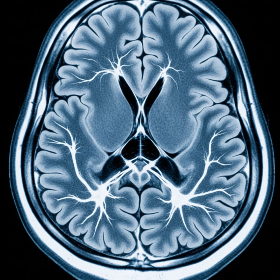 Close-up of a brain scan or neurological imaging.
