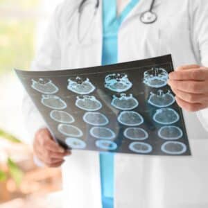 doctor looking at brain scans